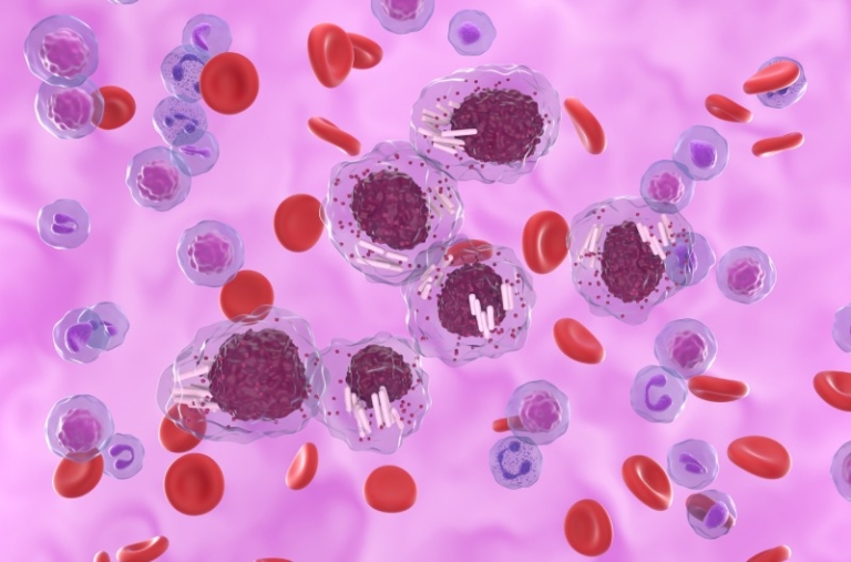 بالا بودن لنفوسیت (Lymphocyte) در آزمایش خون نشانه چیست؟