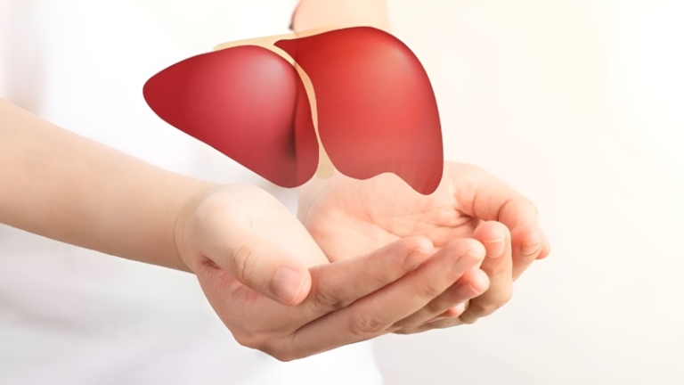 کبد چرب گرید ۱ چیست و چگونه جلوی پیشرفت آن به سیروز کبدی را بگیریم؟