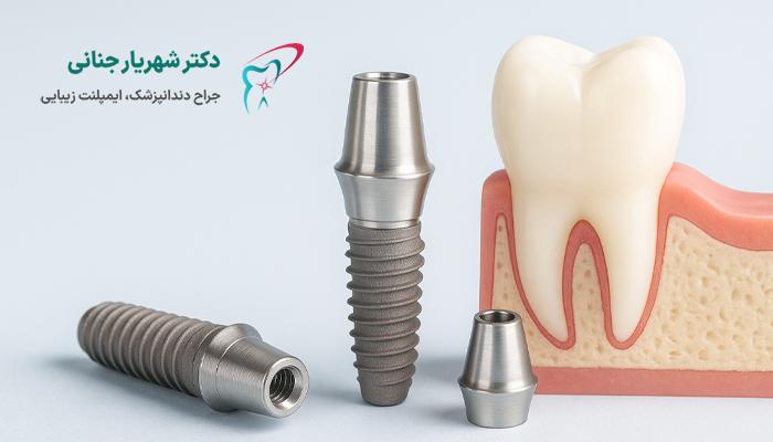 ایمپلنت سوئیسی