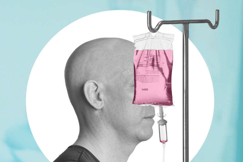 فراموشی بعد از شیمی‌ درمانی: علل، علائم و راهکارهای بازگرداندن تمرکز مغز