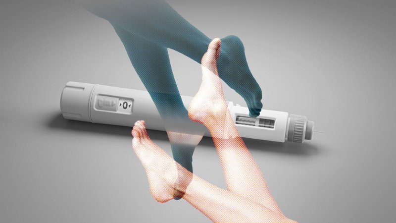 پاهای اوزمپیکی چیست؟ بررسی عارضه جدید کاهش وزن با اوزمپیک
