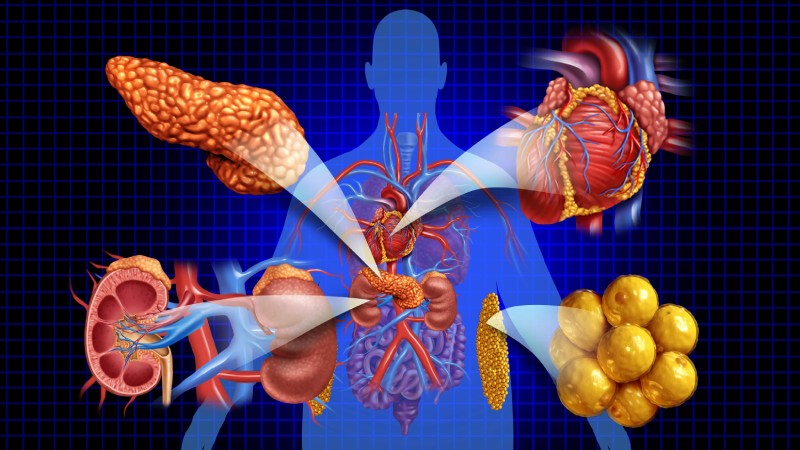 سندرم قلبی، کلیوی و متابولیک یا CKM چیست؟